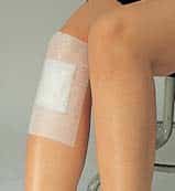 Detox Patch Chi patch applied to the upper arm