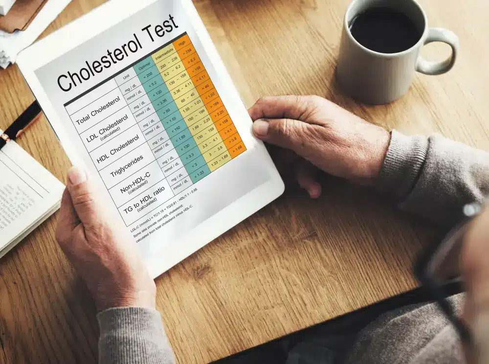 Does Drinking Water Lower Cholesterol? The Honest Science does drinking water lower cholesterol